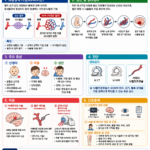 04. 뇌동정맥기형