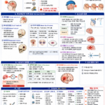 외상성 뇌손상